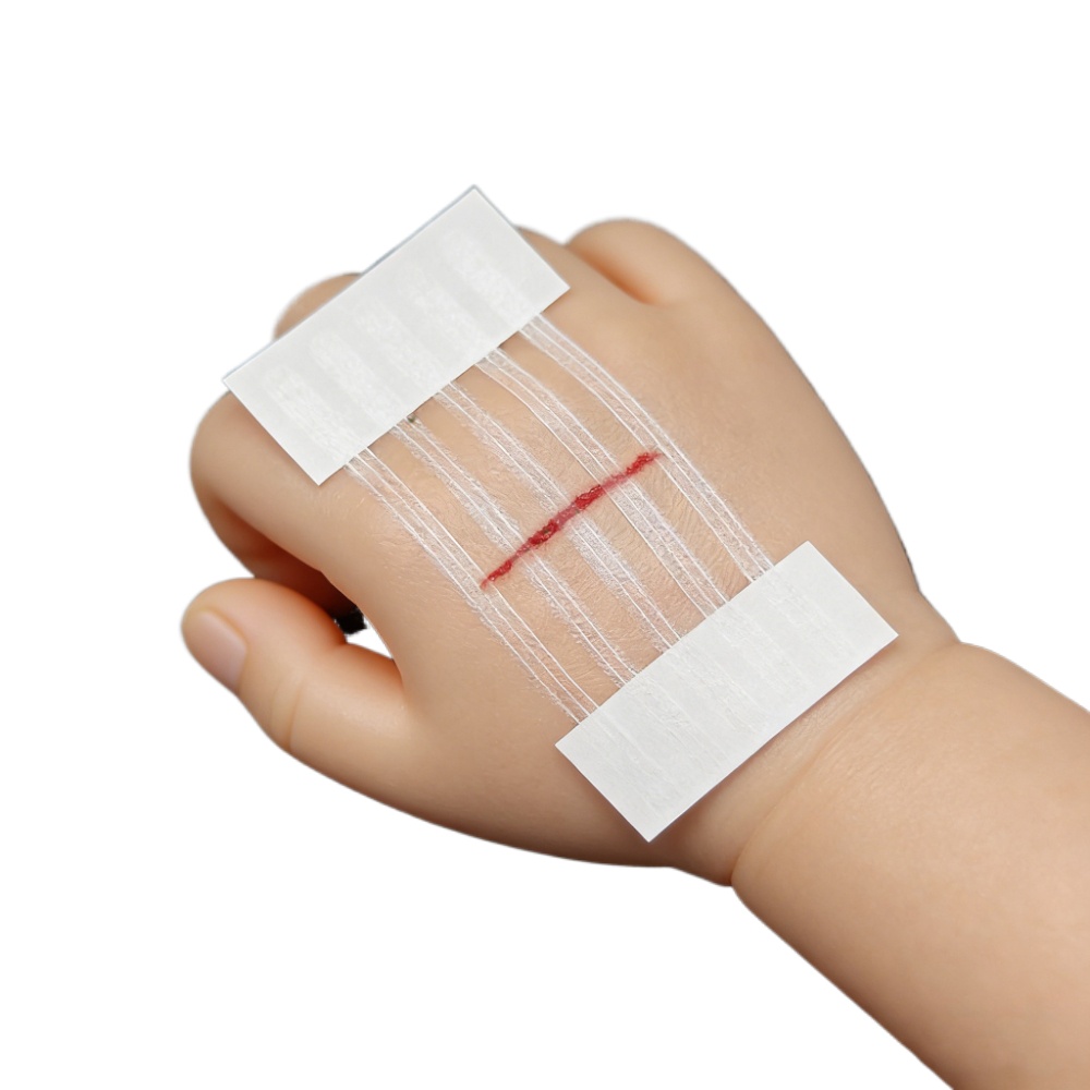 5 Strips Wound Skin Closure St - Medical Label 评论和价格