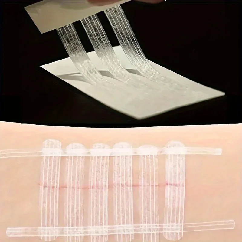 5 Strips Wound Skin Closure St - Medical Label 评论和价格